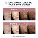 Sérum Facial Eucerin Anti-Pigment Clareador Dual Sérum 30ml