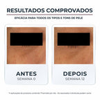 EUCERIN Creme de Olhos Clareador de Olheiras Anti-Pigment 15ml