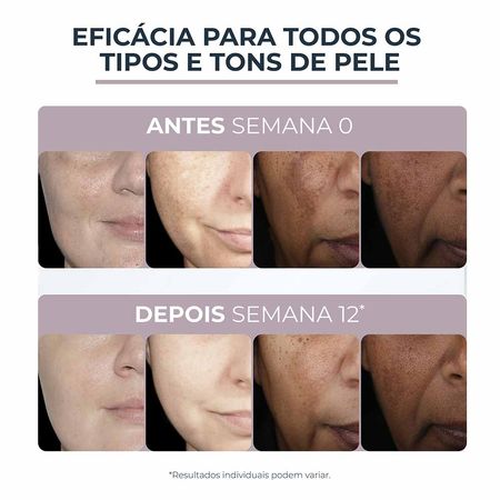 Creme Facial Eucerin Anti-Pigment Noite 50ml